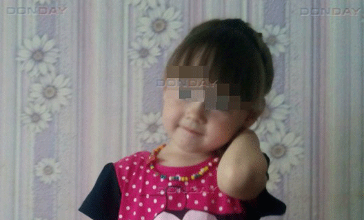 Азов: малышка упала с пятого этажа. Врачи борются за ее жизнь