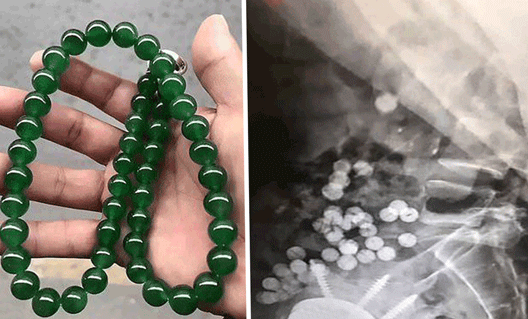 Китаец проглотил ожерелье за 84 млн рублей
